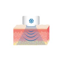 FCE90: vitalising cooling function FCE90: vitalising cooling function