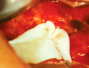 osteobiol_derma_use
