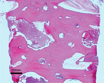 osteobiol_mp3_microscope1